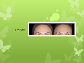 Frente
 