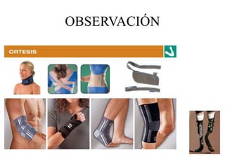 OBSERVACIÓN
 
