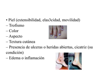 • Piel (extensibilidad, elas3cidad, movilidad)
– Trofismo
– Color
– Aspecto
– Textura cutánea
– Presencia de ulceras o heridas abiertas, cicatriz (su
condición)
– Edema o inflamación
 