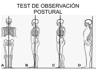 TEST DE OBSERVACIÓN POSTURAL 