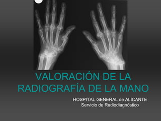 VALORACIÓN DE LA
RADIOGRAFÍA DE LA MANO
HOSPITAL GENERAL de ALICANTE
Servicio de Radiodiagnóstico
 