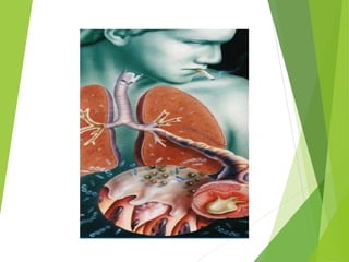 Evaluación neumologica preoperatoria   