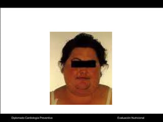 Diplomado Cardiología Preventiva