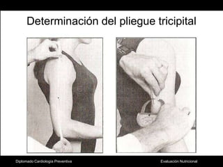 Determinación del pliegue tricipitalDiplomado Cardiología Preventiva