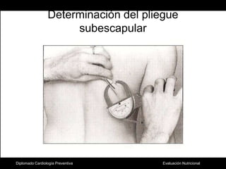Determinación del pliegue subescapularDiplomado Cardiología Preventiva