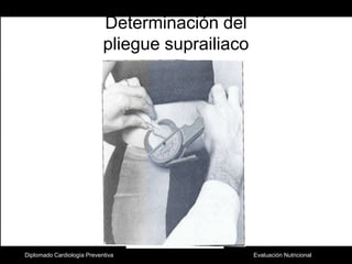 Determinación del pliegue suprailiacoDiplomado Cardiología Preventiva