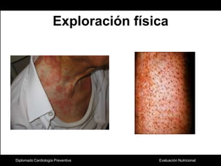 Exploración físicaDiplomado Cardiología Preventiva