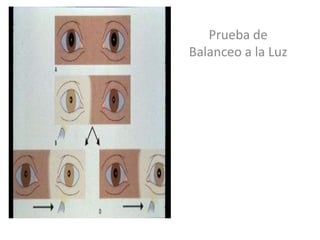 Prueba de
Balanceo a la Luz
 