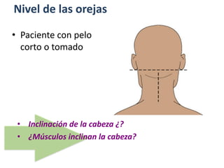 Nivel de las orejas
• Inclinación de la cabeza ¿?
• ¿Músculos inclinan la cabeza?
• Paciente con pelo
corto o tomado
 