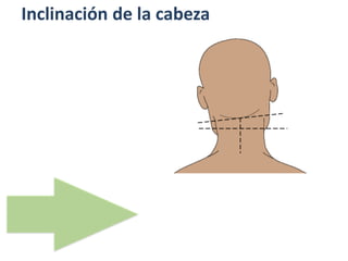 Inclinación de la cabeza
 