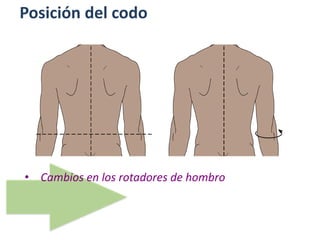Posición del codo
• Cambios en los rotadores de hombro
 