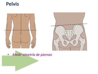 Pelvis
• Medir simetría de piernas
 