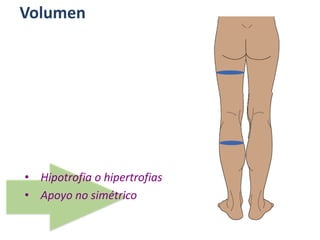 Volumen
• Hipotrofia o hipertrofias
• Apoyo no simétrico
 