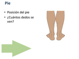 Pie
• Posición del pie
• ¿Cuántos dedos se
ven?
 
