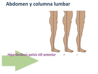 Abdomen y columna lumbar
Hiperlordosis pelvis tilt anterior
 