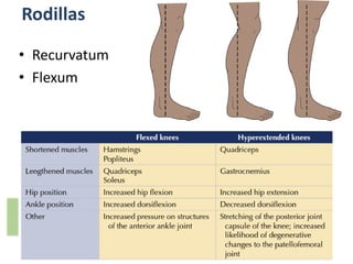 Rodillas
• Recurvatum
• Flexum
 