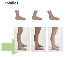 Tobillos
 