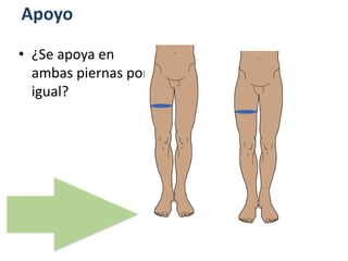Apoyo
• ¿Se apoya en
ambas piernas por
igual?
 