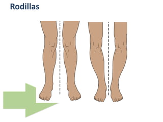 Rodillas
 