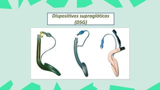 Dispositivos supraglóticos
(DSG)
 