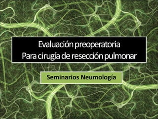 Seminarios Neumología 