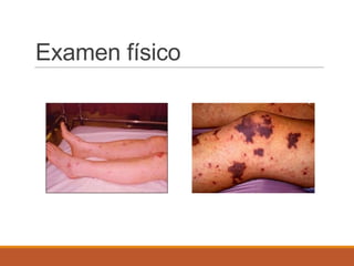 Examen físico
 