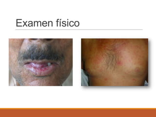 Examen físico
 
