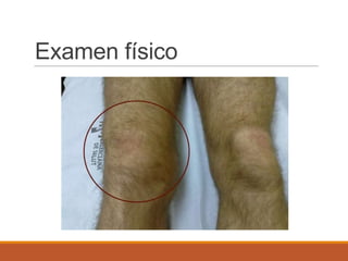 Examen físico
 