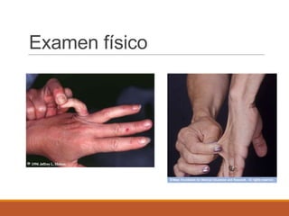 Examen físico
 