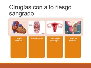 Cirugías con alto riesgo
sangrado
Cirugía
Cardiaca
Amigdalectomía Ginecología
Oncológica
Cirugía de
Prostata
 