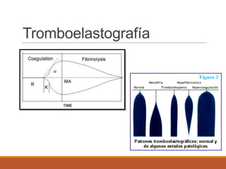 Tromboelastografía
 
