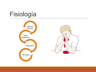 Fisiología
Espasmo
Vascular
Tapón
plaquetario
Coagulación
Fibrinólisis
 