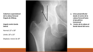 Evaluación radiografía de la cadera. para todos pptx | PPTX