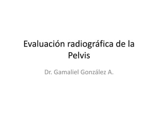 Evaluación radiográfica de la 
Pelvis 
Dr. Gamaliel González A. 
 