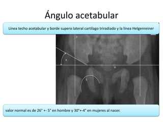 Evaluación radiográfica de la pelvis | PPTX