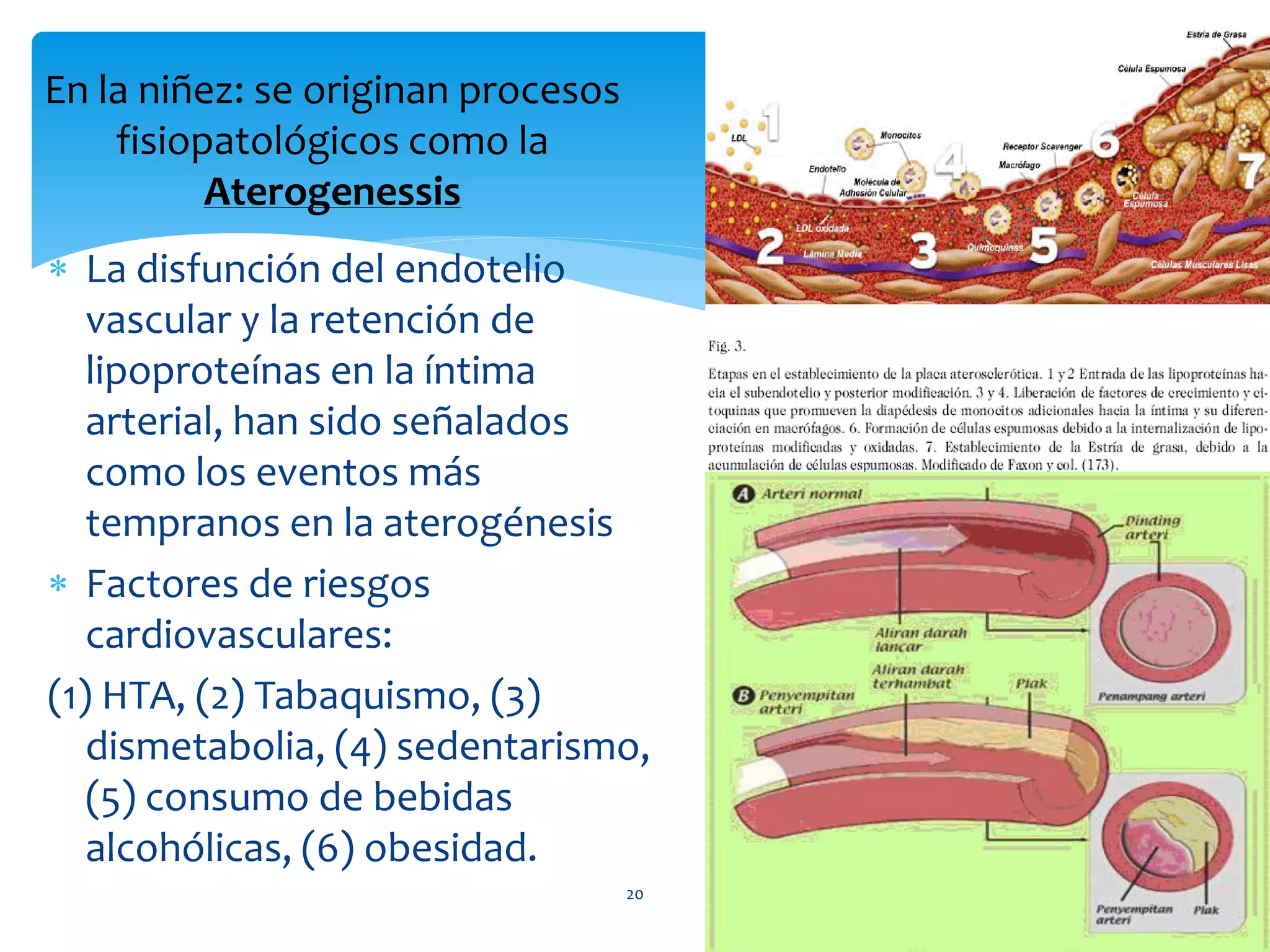 En la niñez: se originan procesos
    fisiopatológicos como la
          Aterogenessis
 La disfunción del endotelio
   vascular y la retención de
   lipoproteínas en la íntima
   arterial, han sido señalados
   como los eventos más
   tempranos en la aterogénesis
 Factores de riesgos
   cardiovasculares:
(1) HTA, (2) Tabaquismo, (3)
   dismetabolia, (4) sedentarismo,
   (5) consumo de bebidas
   alcohólicas, (6) obesidad.
                                    20
 