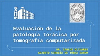 Evaluación de la
patología torácica por
tomografía computarizada
DR. CARLOS OLIVARES
ADJUNTO CIRUGÍA DE TÓRAX SAHUM
 