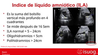 Ila Normal EVALUACION DE PLACENTA Y LIQUIDO AMNIOTICO.pptx