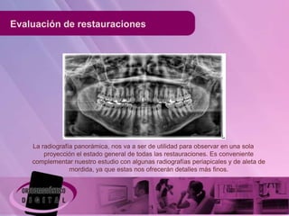 Evaluación de restauraciones




    La radiografía panorámica, nos va a ser de utilidad para observar en una sola
        proyección el estado general de todas las restauraciones. Es conveniente
    complementar nuestro estudio con algunas radiografías periapicales y de aleta de
                 mordida, ya que estas nos ofrecerán detalles más finos.
 