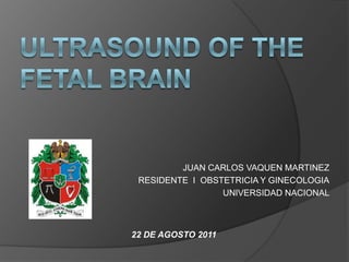 Ultrasound of the Fetal Brain JUAN CARLOS VAQUEN MARTINEZ RESIDENTE  I  OBSTETRICIA Y GINECOLOGIA UNIVERSIDAD NACIONAL 22 DE AGOSTO 2011 