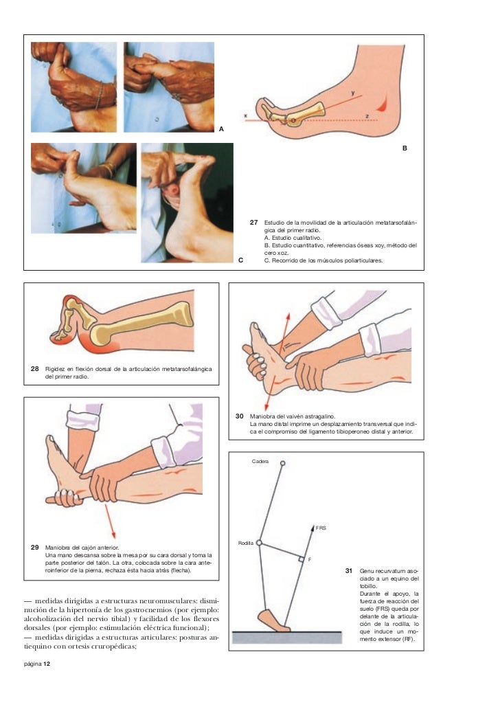 Evaluaciones articulares del tobillo y el pie en el adulto