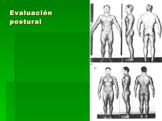 Evaluación postural 