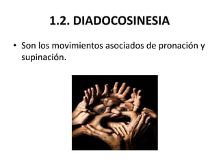 1.2. DIADOCOSINESIA
• Son los movimientos asociados de pronación y
  supinación.
 