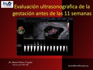 Evaluación ultrasonografica de la
gestación antes de las 11 semanas
Dr. Romel Flores Virgilio
Director del IMUMR
 