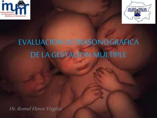 EVALUACION ULTRASONOGRAFICA DE LA GESTACION MULTIPLE 
Dr. Romel Flores Virgilio  