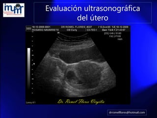 Evaluación ultrasonográfica del útero 
Dr. Romel Flores Virgilio  