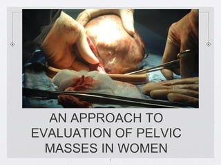 AN APPROACH TO
EVALUATION OF PELVIC
  MASSES IN WOMEN
          1
 