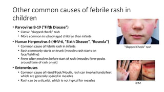 Comprehensive Guide to Evaluating Rash and Suspected Measles Cases ...