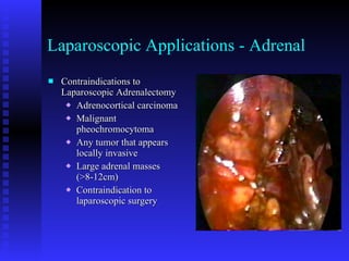 Laparoscopic Applications - Adrenal Contraindications to Laparoscopic Adrenalectomy Adrenocortical carcinoma  Malignant pheochromocytoma Any tumor that appears locally invasive Large adrenal masses (>8-12cm) Contraindication to laparoscopic surgery 