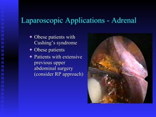 Laparoscopic Applications - Adrenal Obese patients with Cushing’s syndrome Obese patients Patients with extensive previous upper abdominal surgery (consider RP approach) 